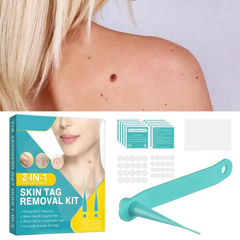 Home Skin Tag Removal Kit