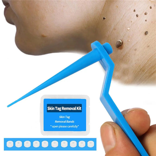 Micro Skin Tag Remover Kit Body - 10PCS/20PCS/30PCS/50PCS