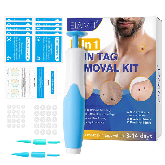 Painless Skin Tag Removal Kit