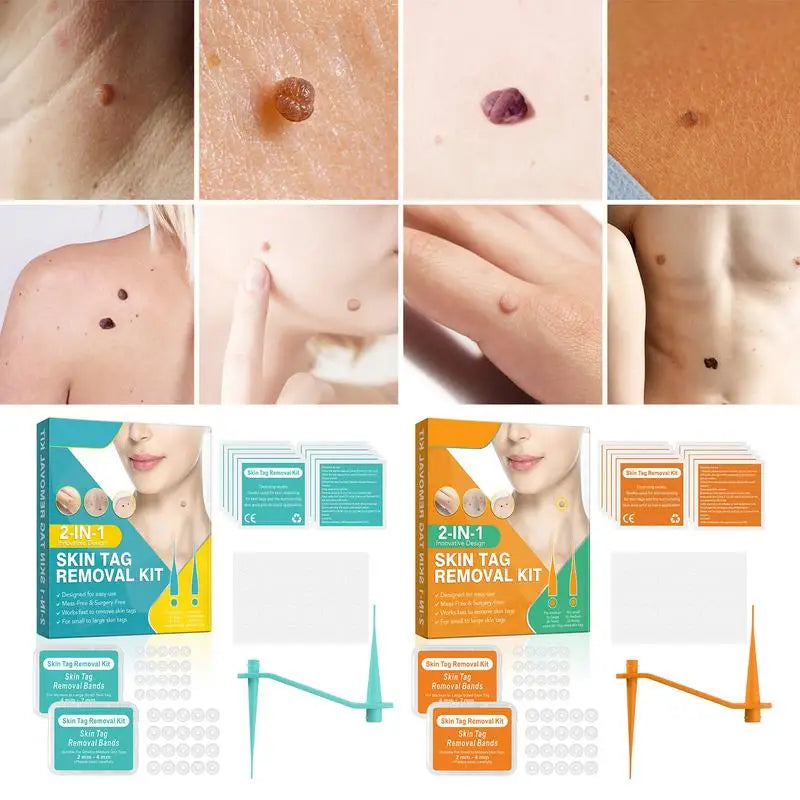 Home Skin Tag Removal Kit